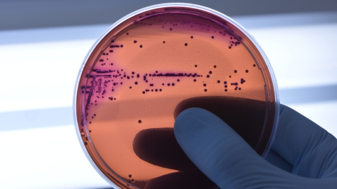 bacteria_resistencia_antibioticos_fiocruz-6